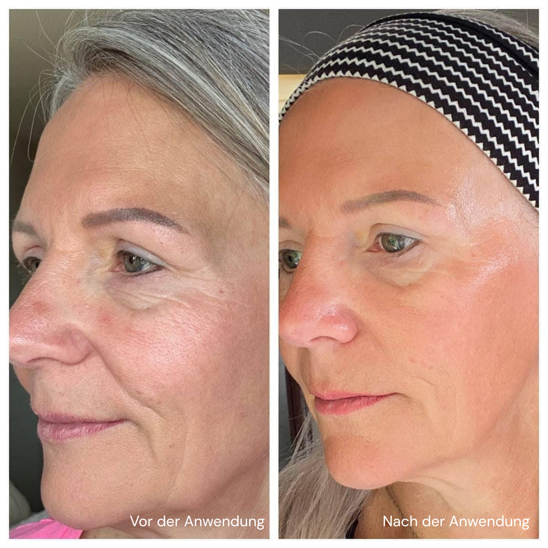 Luunae™ Contour Bürste