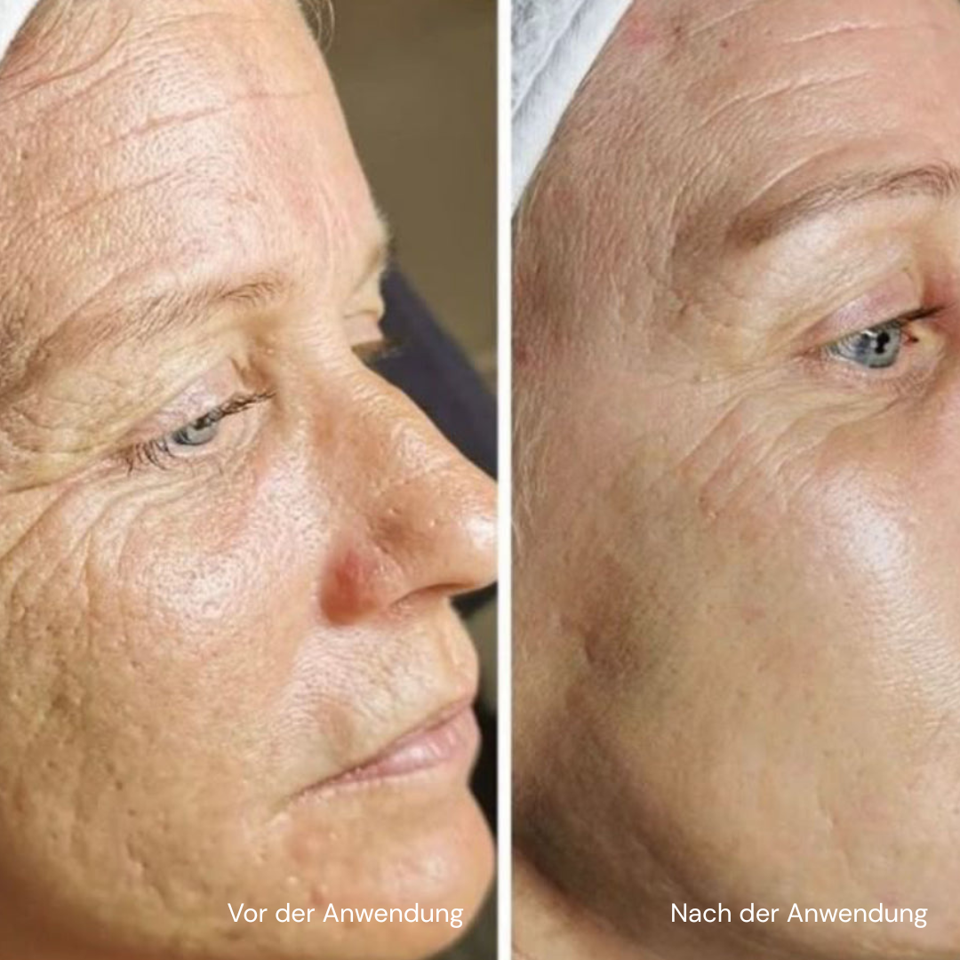 Luunae™ Contour Bürste
