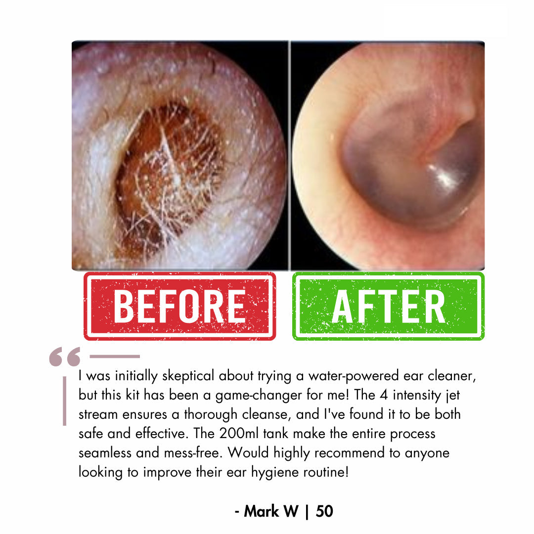 LUUNAE™ Ear Wax Remover