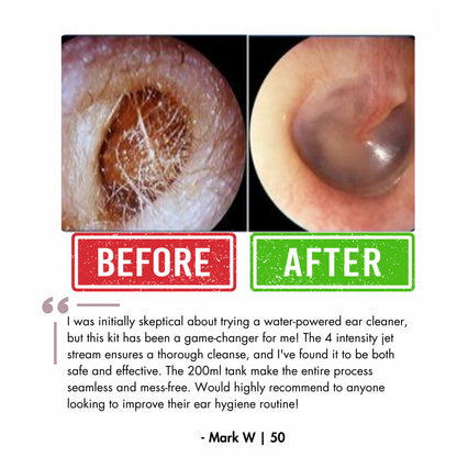 LUUNAE™ Ear Wax Remover